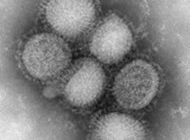 H1N1 Influenza virus image