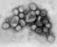 This negative stained transmission electron micrograph (TEM) depicted some of the ultrastructural morphology of the A/CA/4/09 swine flu virus.