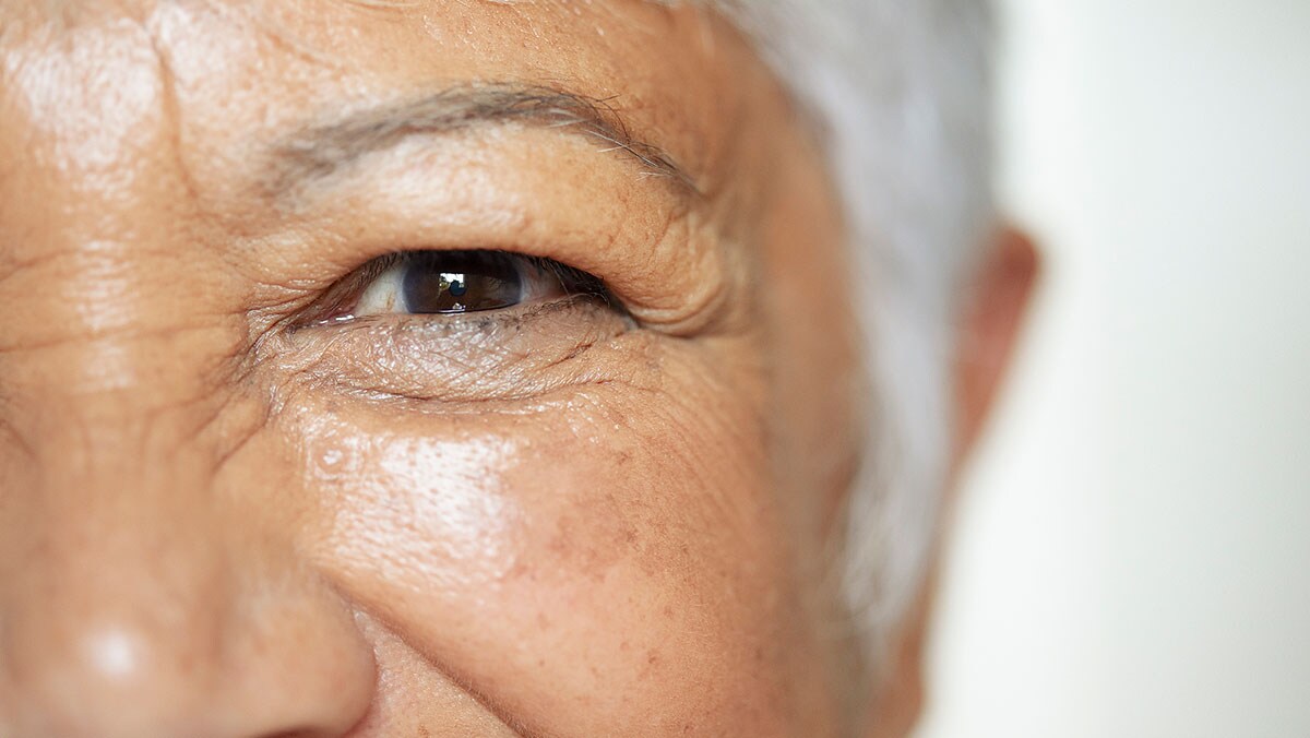 Closeup of a senior woman’s eye
