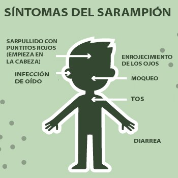 Síntomas del sarampión